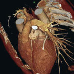 Полнейшая инструкция по прохождению эхокардиографии сердца